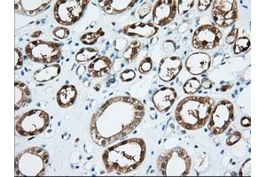 Image no. 6 for anti-3-hydroxybutyrate Dehydrogenase, Type 2 (BDH2) antibody (ABIN1496857) (BDH2 antibody)