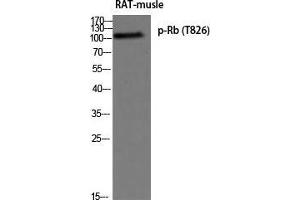 Western Blot (WB) analysis of Rat Muscle using p-Rb (T826) antibody. (Retinoblastoma 1 antibody  (pThr826))