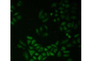 Figure. (QSOX1 antibody  (AA 394-519))