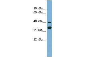 WB Suggested Anti-GPN2 Antibody Titration: 0. (GPN2 antibody  (Middle Region))