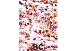 Immunohistochemistry (IHC) image for anti-Pantothenate Kinase 1 (PANK1) antibody (ABIN3003019) (PANK1 antibody)