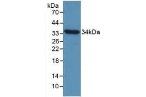 Detection of Recombinant CCND1, Gallus using Monoclonal Antibody to Cyclin D1 (CCND1) (Cyclin D1 antibody  (AA 1-292))