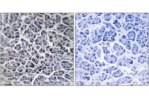 Immunohistochemistry analysis of paraffin-embedded human pancreas tissue, using PPM1K Antibody. (PPM1K antibody  (AA 205-254))