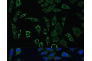 Immunofluorescence analysis of L929 cells using AEBP1 Polyclonal Antibody at dilution of 1:100 (40x lens). (AEBP1 antibody)