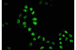 Immunofluorescence staining of Hela cells with ABIN7127541 at 1:51, counter-stained with DAPI. (Recombinant HDAC9 antibody)