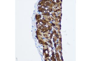 Immunohistochemistry of paraffin-embedded Rat lung using PP1 beta Rabbit pAb (ABIN3021408, ABIN3021409, ABIN3021410 and ABIN6215019) at dilution of 1:100 (40x lens).