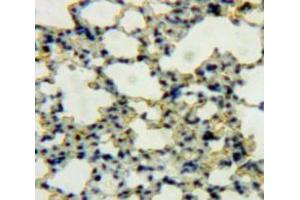 IHC-P analysis of Lung tissue, with DAB staining. (DEFB119 antibody  (AA 22-84))