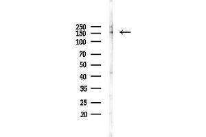 Western blot analysis of lysates from PC12 cells(LPS 4h treatment), using Phospho-MEKK1 (Thr1402) Antibody at 1/1000 dilution.