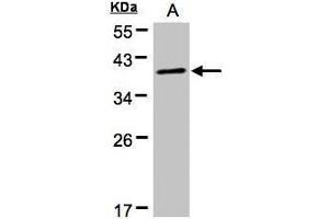 WB Image Sample(30 μg of whole cell lysate) A:HeLa S3, 12% SDS PAGE antibody diluted at 1:500 (PRKACA antibody  (Center))