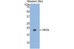 Western Blotting (WB) image for anti-Retinol Binding Protein 2, Cellular (RBP2) (AA 1-134) antibody (ABIN1078477) (RBP2 antibody  (AA 1-134))