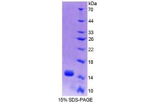 Image no. 1 for Acylphosphatase 2, Muscle Type (Acyp2) (AA 2-106) protein (His tag) (ABIN6239074) (Acyp2 Protein (AA 2-106) (His tag))