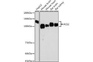 Western blot analysis of extracts of various cell lines, using  antibody  at 1:500 dilution. (ACE2 antibody)