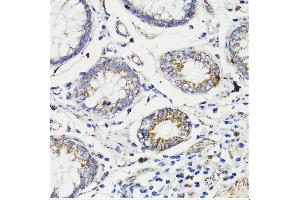 Immunohistochemistry (IHC) image for anti-Caspase 8 (CASP8) (AA 1-479) antibody (ABIN6137970)