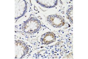 IHC (Caspase 8 antibody  (AA 1-479))