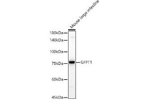 Western blot analysis of extracts of Mouse large intestine, using GFPT1 antibody (ABIN7267430) at 1:1000 dilution. (GFPT1 antibody)