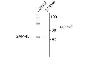 Image no. 1 for anti-Growth Associated Protein 43 (GAP43) (pSer41) antibody (ABIN372649) (GAP43 antibody  (pSer41))