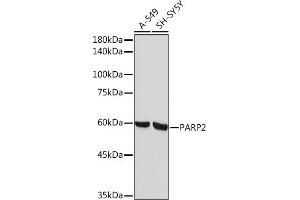 Western blot analysis of extracts of various cell lines, using P Rabbit mAb (ABIN7269441) at 1:1000 dilution. (PARP2 antibody)