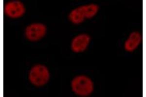ABIN6269183 staining HeLa by IF/ICC. (ELK1 antibody  (C-Term))