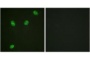 Immunofluorescence analysis of HeLa cells, using ERF (Phospho-Thr526) Antibody. (ERF antibody  (pThr56))