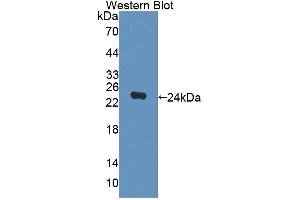 Figure. (DPEP2 antibody  (AA 303-486))