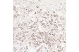 Immunohistochemistry (IHC) image for anti-Casein Kinase 2 alpha 1 (CSNK2A1) (AA 300-350) antibody (ABIN7454514)
