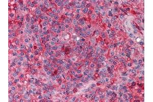 Immunohistochemical analysis of paraffin-embedded human Spleen tissues using anti-ARNTL antibody (ARNTL antibody)