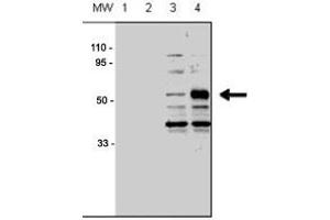 Western blot analysis of ACVRL1 polyclonal antibody  in human chondrocytes (C-28/I2 cells), transfected with empty vector (lane 1, 3) or ACVRL1 (lane 2, 4). (ACVRL1 antibody  (N-Term))