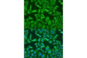 Immunofluorescence analysis of U2OS cells using KIF11 antibody. (KIF11 antibody  (AA 797-1056))