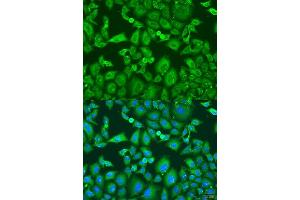 Immunofluorescence analysis of U2OS cells using KIF11 antibody. (KIF11 antibody  (AA 797-1056))