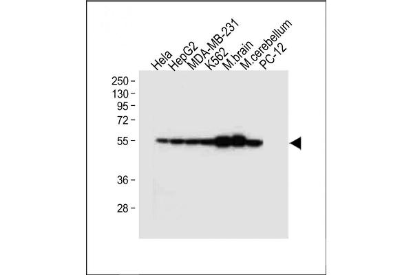 TUBB2B antibody  (N-Term)