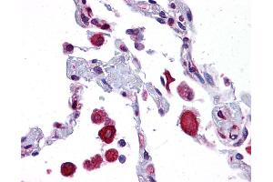 EIF2AK1 antibody was used for immunohistochemistry at a concentration of 4-8 ug/ml.