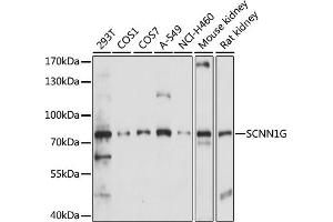 Western blot analysis of extracts of various cell lines, using SCNN1G antibody (ABIN7270387) at 1:1000 dilution. (SCNN1G antibody  (AA 100-250))