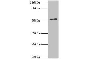 Western blot All lanes: RAD18 antibody at 2 μg/mL + COLO205 whole cell lysate Secondary Goat polyclonal to rabbit IgG at 1/10000 dilution Predicted band size: 57 kDa Observed band size: 57 kDa (RAD18 antibody  (AA 1-495))