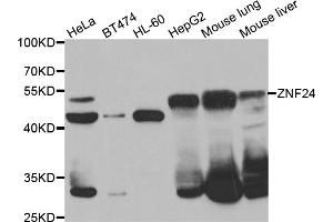 Western blot analysis of extracts of various cell lines, using ZNF24 antibody (ABIN5975578) at 1/1000 dilution. (ZNF24 antibody)