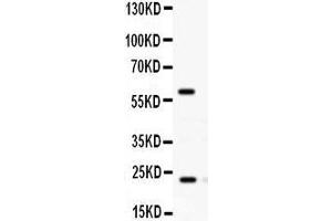 Observed bind size: 24KD,60KD (RAB11A antibody  (C-Term))