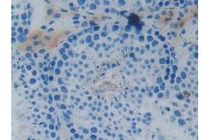 Detection of MAPT in Mouse Testis Tissue using Polyclonal Antibody to Tau Protein (MAPT) (tau antibody  (AA 92-400))