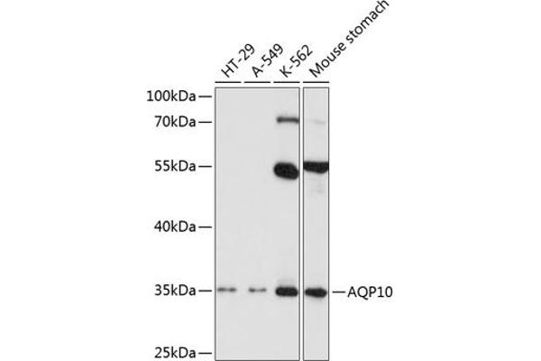 Aquaporin 10 antibody  (AA 209-301)