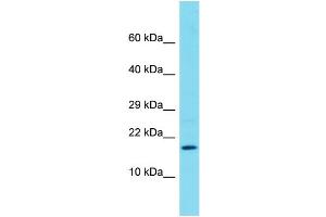 Western Blotting (WB) image for anti-Family with Sequence Similarity 183, Member B (FAM183B) (C-Term) antibody (ABIN2791535) (FAM183B antibody  (C-Term))