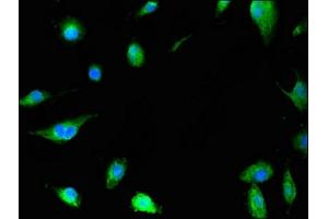 Immunofluorescent analysis of U251 cells using ABIN7155043 at dilution of 1:100 and Alexa Fluor 488-congugated AffiniPure Goat Anti-Rabbit IgG(H+L) (c-MET antibody  (AA 83-209))