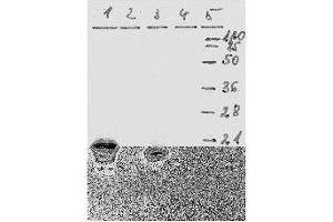 Western Blotting (WB) image for anti-Human Papilloma Virus 18 E7 (HPV-18 E7) (AA 36-70) antibody (ABIN781778) (HPV18 E7 antibody  (AA 36-70))