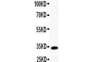 Anti-TARC Picoband antibody,  All lanes: Anti-TARC at 0. (CCL17 antibody  (AA 34-103))