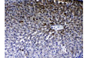 IHC analysis of ErbB 2 using anti- ErbB 2 antibody . (ErbB2/Her2 antibody  (N-Term))
