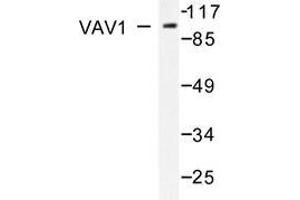 Western blot analysis of VAV1 antibody in extracts from K562 cells treated with UV 15'. (VAV1 antibody)