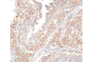 Immunohistochemistry of paraffin-embedded Rat ovary using KIF14 Polyclonal Antibody at dilution of 1:100 (40x lens). (KIF14 antibody)