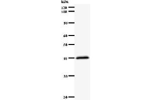 Western Blotting (WB) image for anti-Nuclear Factor (erythroid-Derived 2)-Like 2 (NFE2L2) antibody (ABIN931118) (NRF2 antibody)