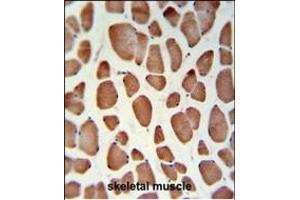 HSD11B2 Antibody (Center) (ABIN653721 and ABIN2843030) IHC analysis in formalin fixed and paraffin embedded skeletal muscle followed by peroxidase conjugation of the secondary antibody and DAB staining. (HSD11B2 antibody  (AA 277-306))
