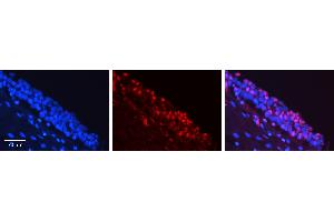 Immunohistochemistry (IHC) image for anti-FOS-Like Antigen 1 (FOSL1) (Middle Region) antibody (ABIN2777265)