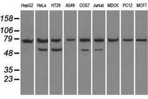Western blot analysis of extracts (35 µg) from 9 different cell lines by using anti-HSPA9 monoclonal antibody. (HSPA9 antibody)
