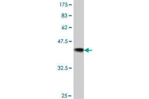 Western Blot detection against Immunogen (37. (Catalase antibody  (AA 1-100))