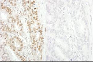 Immunohistochemistry (IHC) image for anti-Minichromosome Maintenance Complex Component 2 (MCM2) (pSer53) antibody (ABIN7448649)
